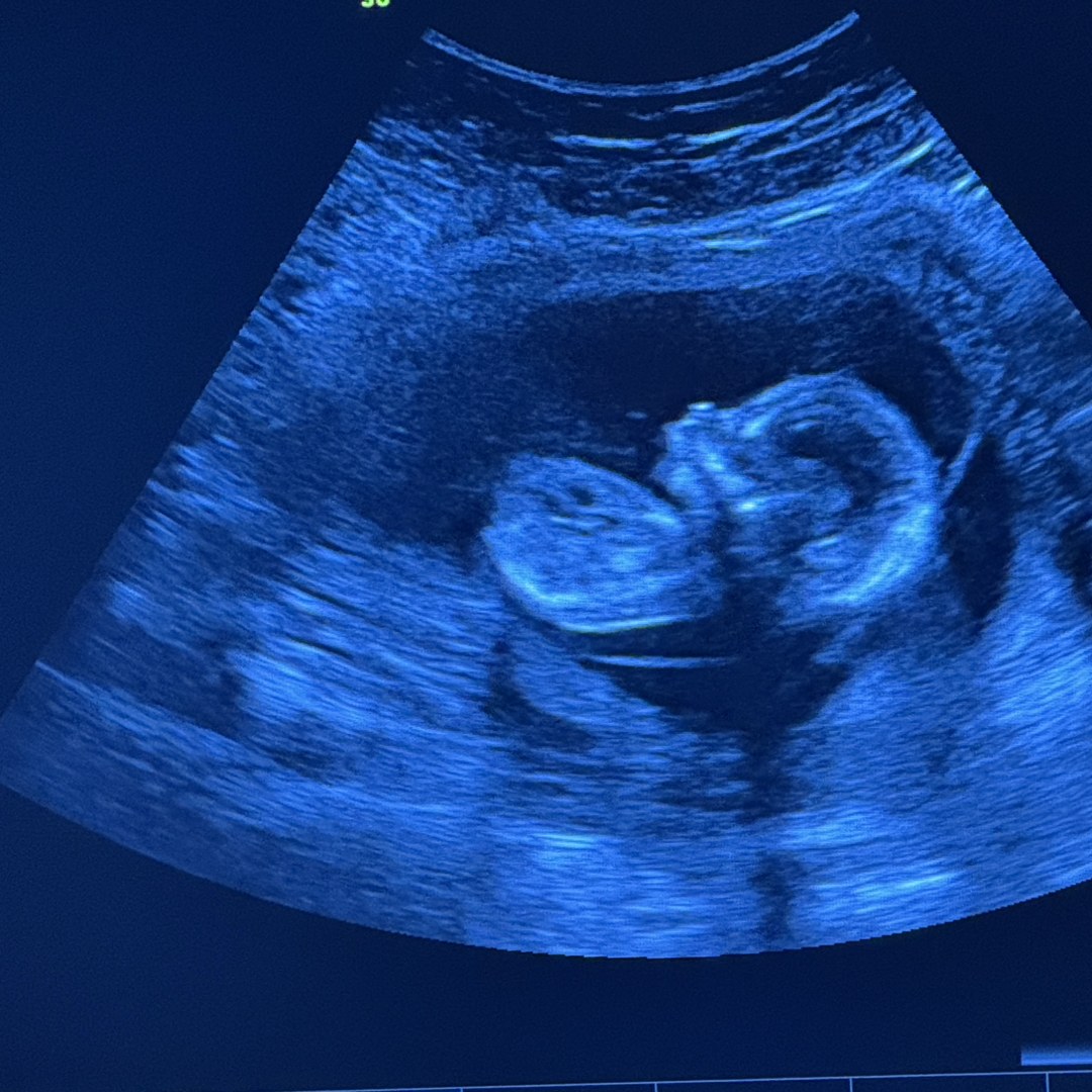 Photo shared by Tara for their Babylist baby registry.