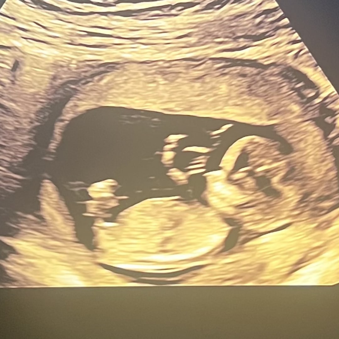 Photo shared by Damiana for their Babylist baby registry.