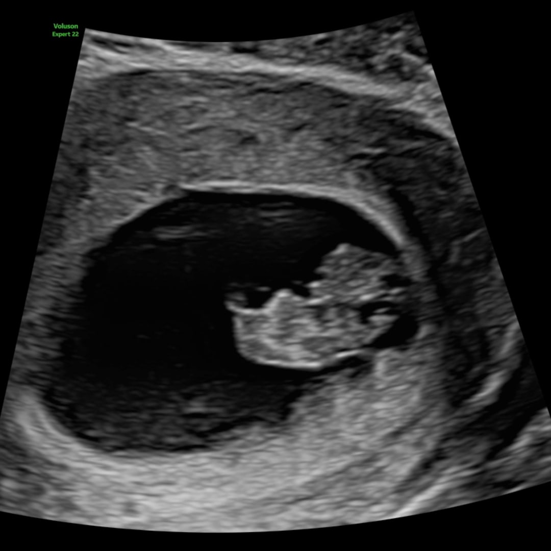 Photo shared by Angelina for their Babylist baby registry.