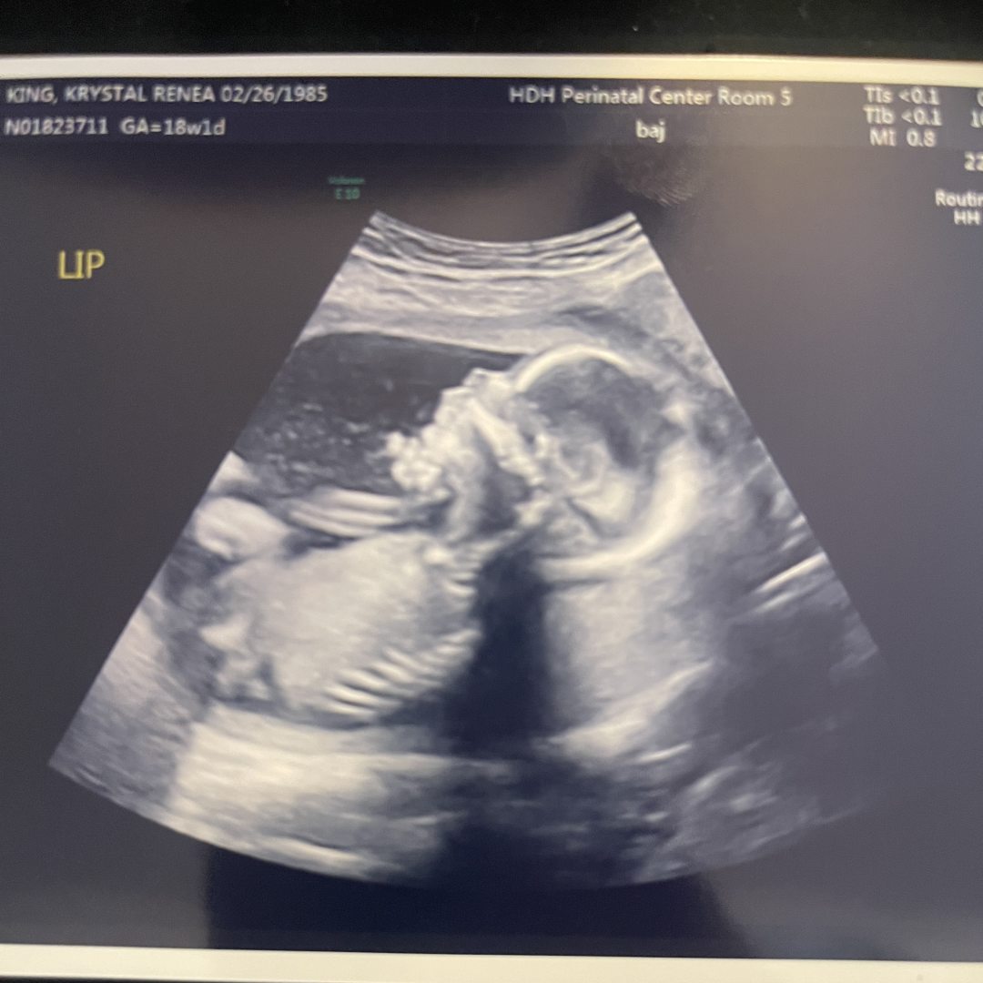 Photo shared by Kay for their Babylist baby registry.