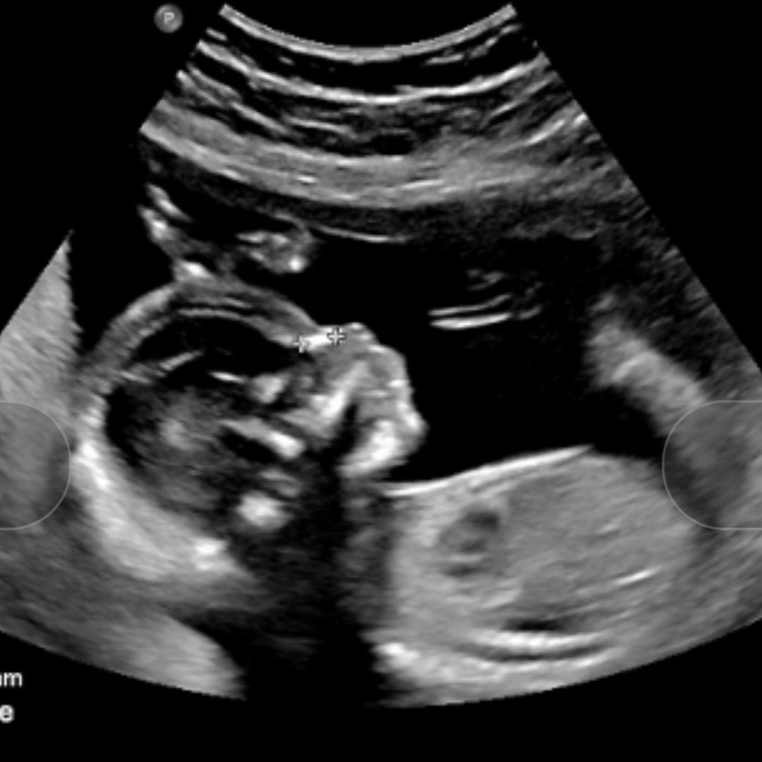 Photo shared by Amera for their Babylist baby registry.