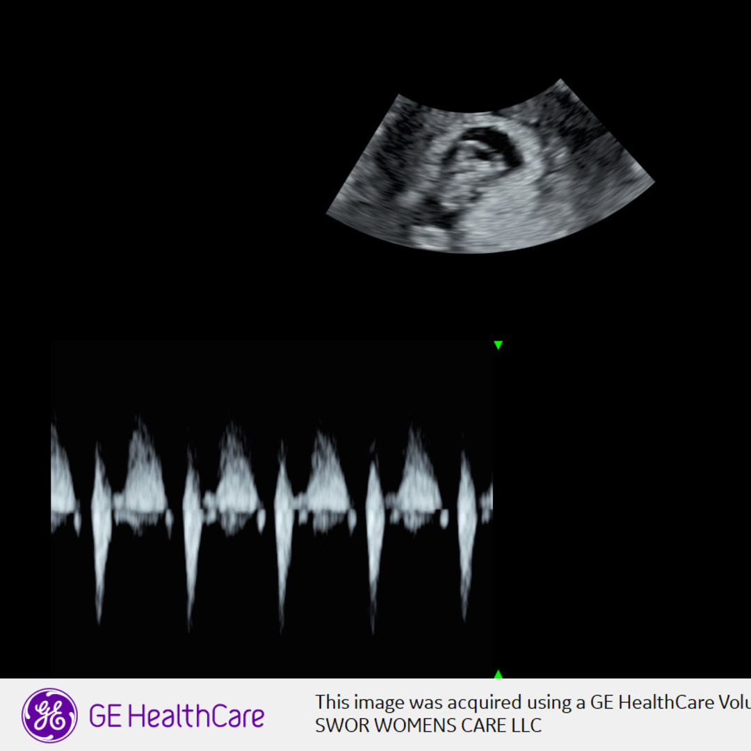 Photo shared by Samantha for their Babylist baby registry.