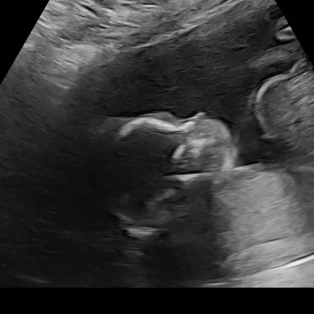 Photo shared by Mercedes for their Babylist baby registry.