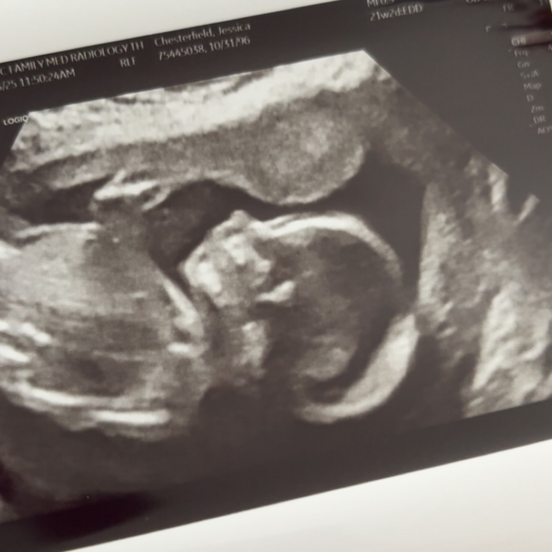 Photo shared by Jessica for their Babylist baby registry.