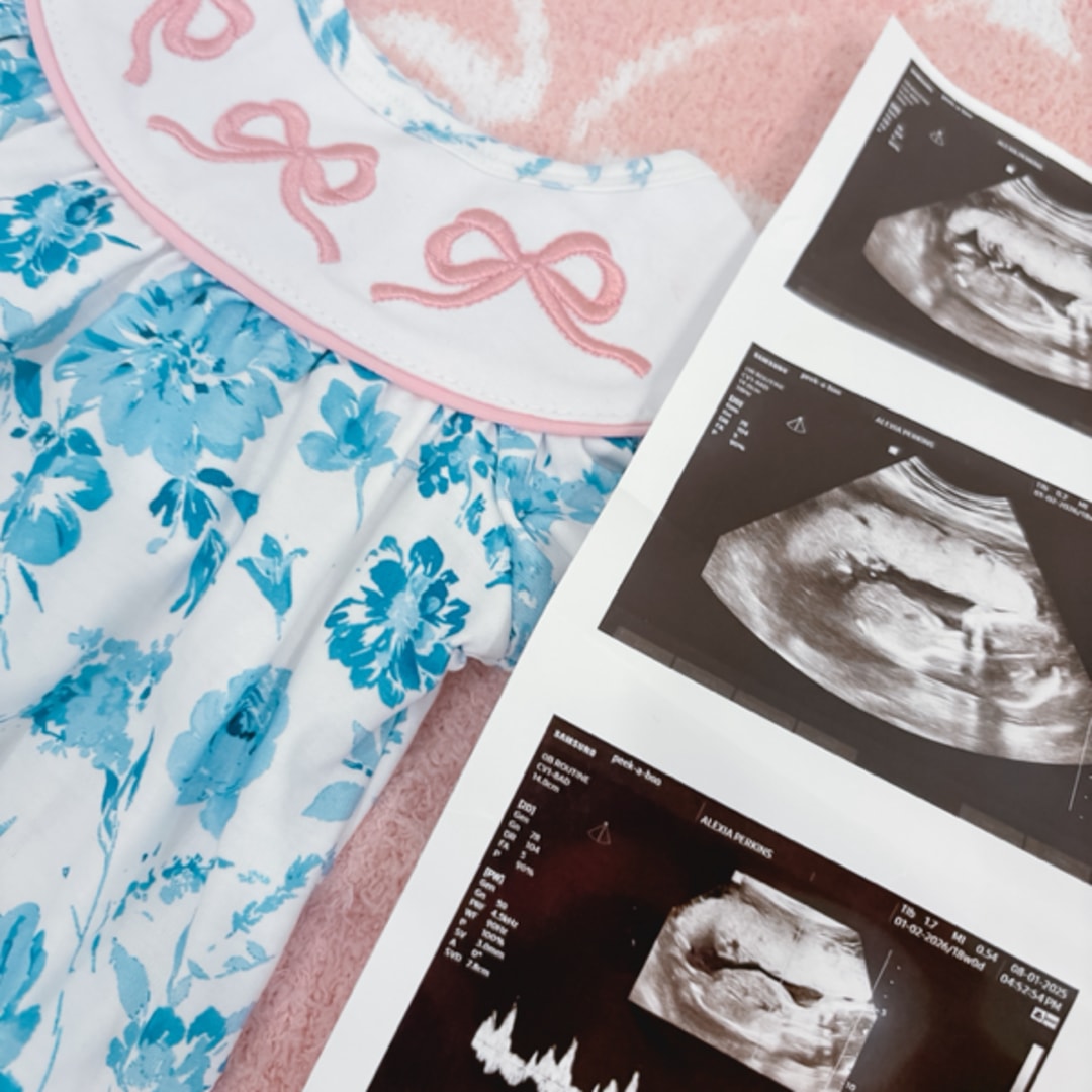 Photo shared by Lexi for their Babylist baby registry.