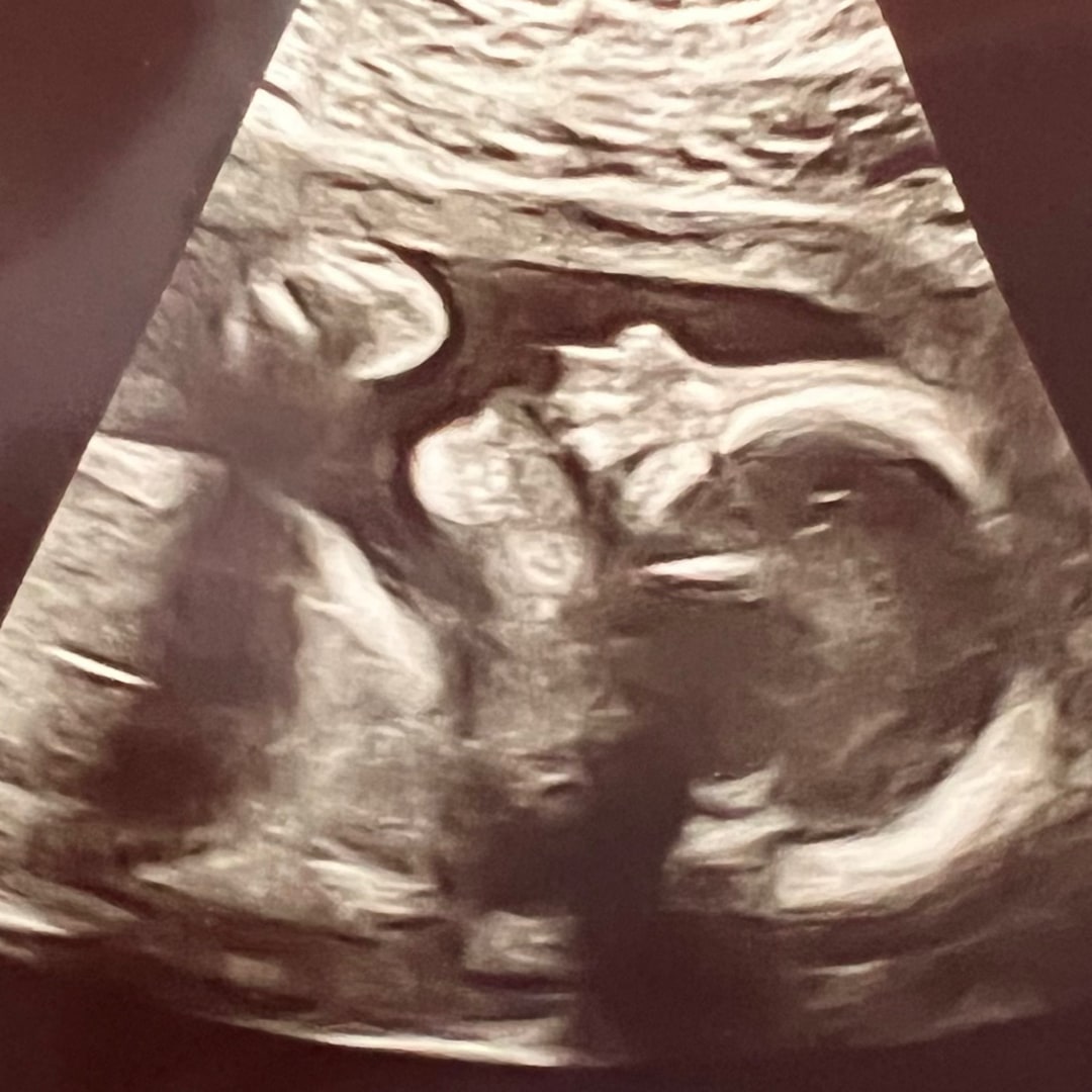 Photo shared by Katherine for their Babylist baby registry.