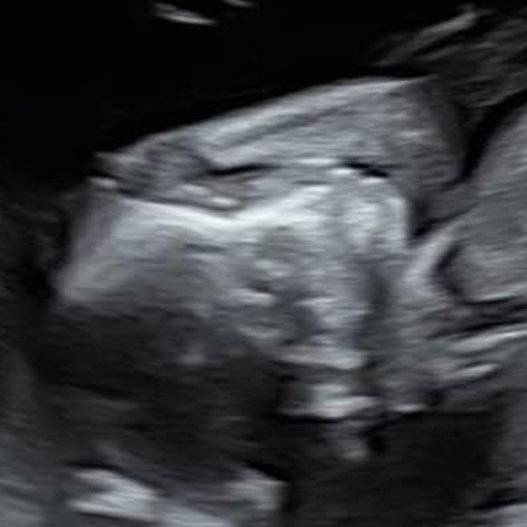 Photo shared by Holly for their Babylist baby registry.