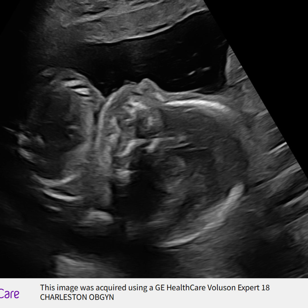 Photo shared by Aly for their Babylist baby registry.