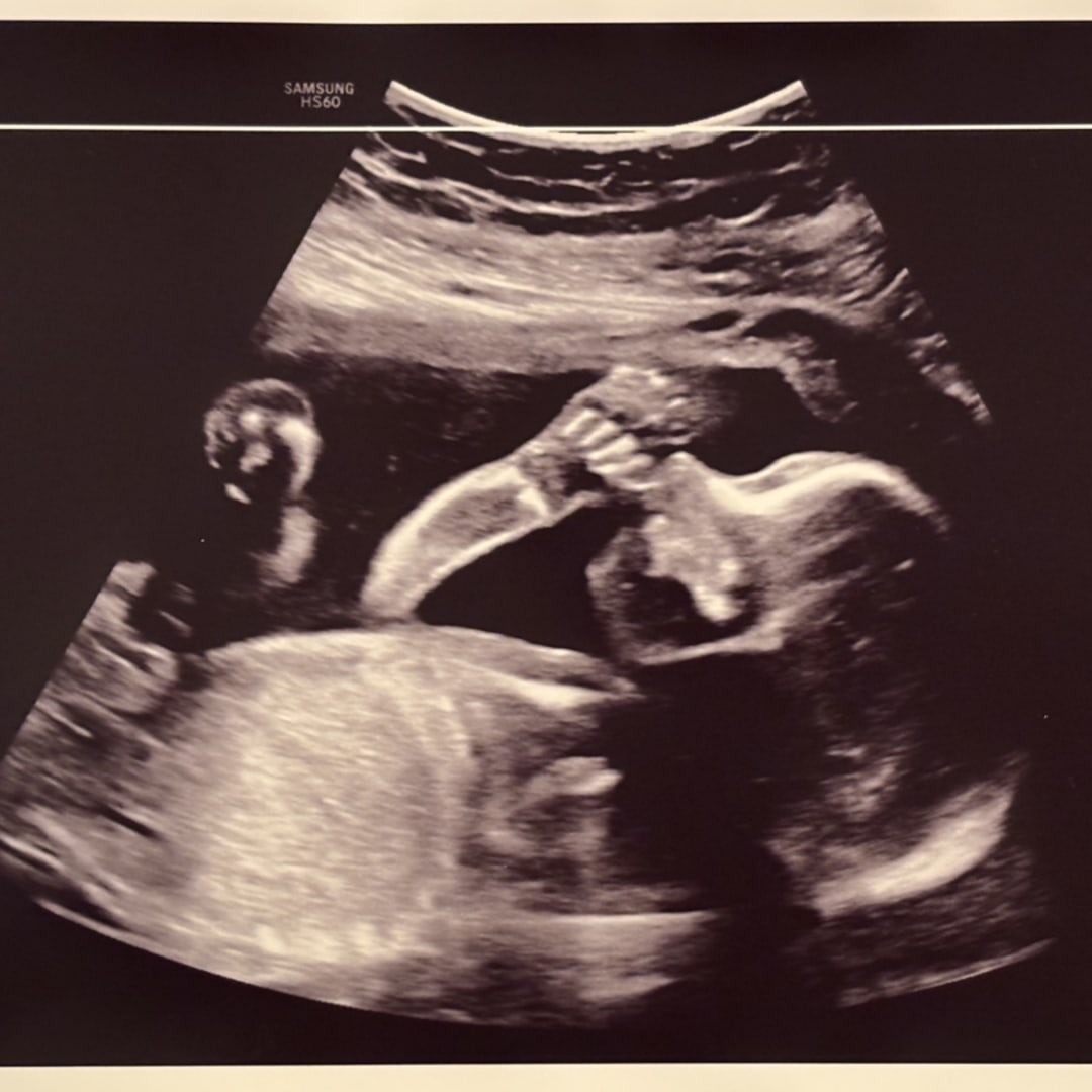 Photo shared by Chelsea for their Babylist baby registry.