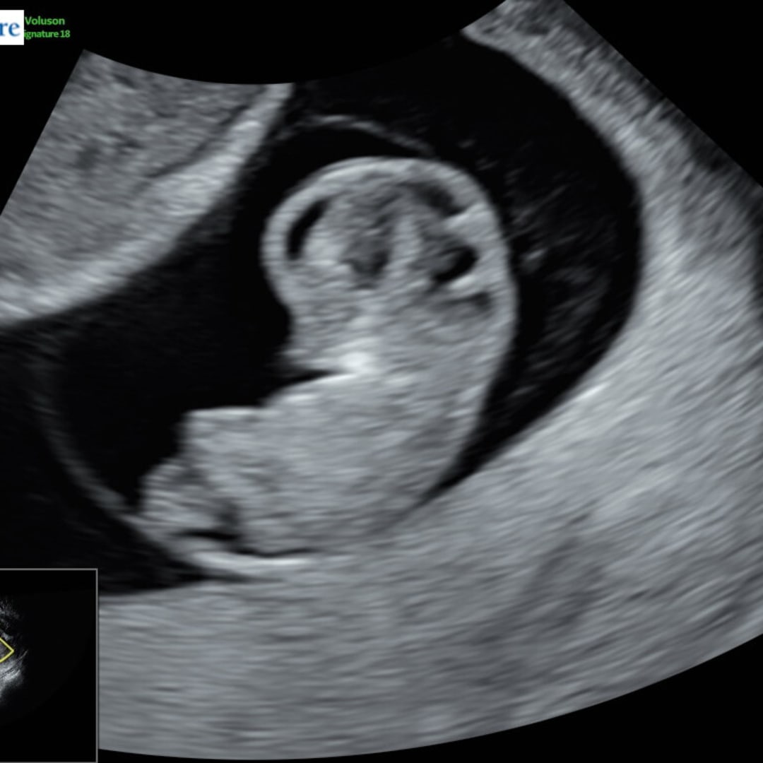 Photo shared by Rachel for their Babylist baby registry.