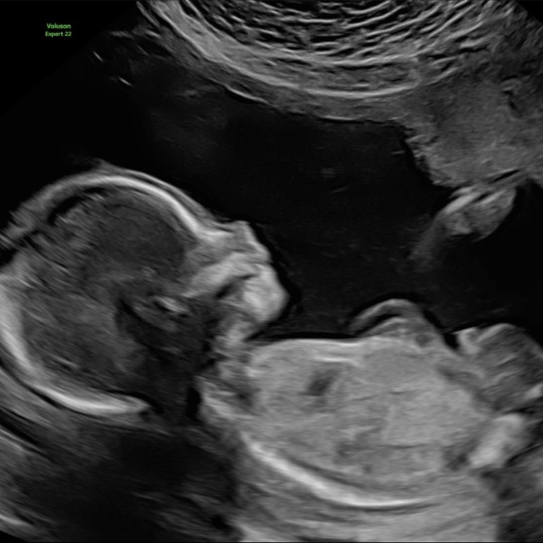 Photo shared by Shelby for their Babylist baby registry.