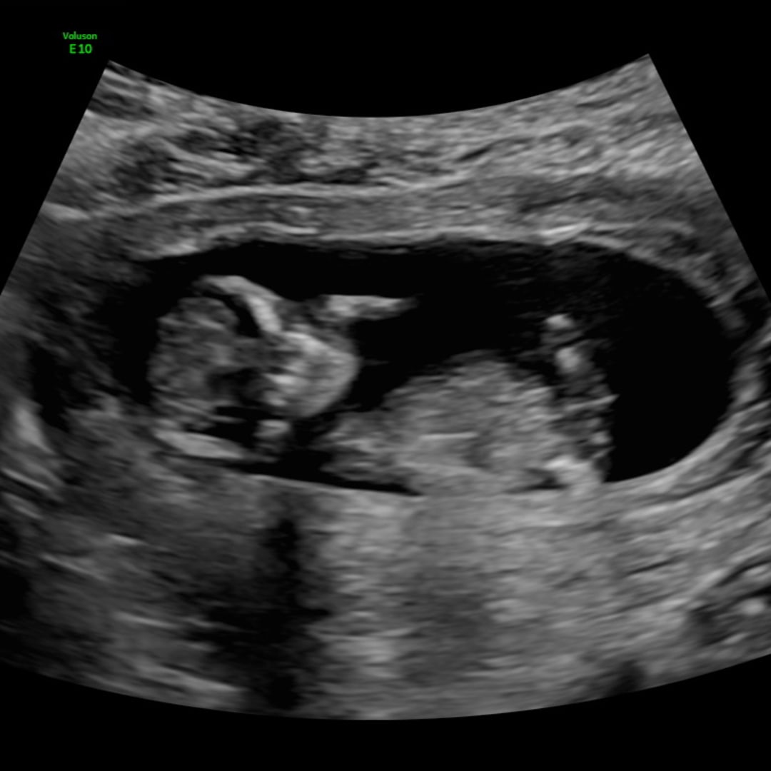 Photo shared by Briana for their Babylist baby registry.