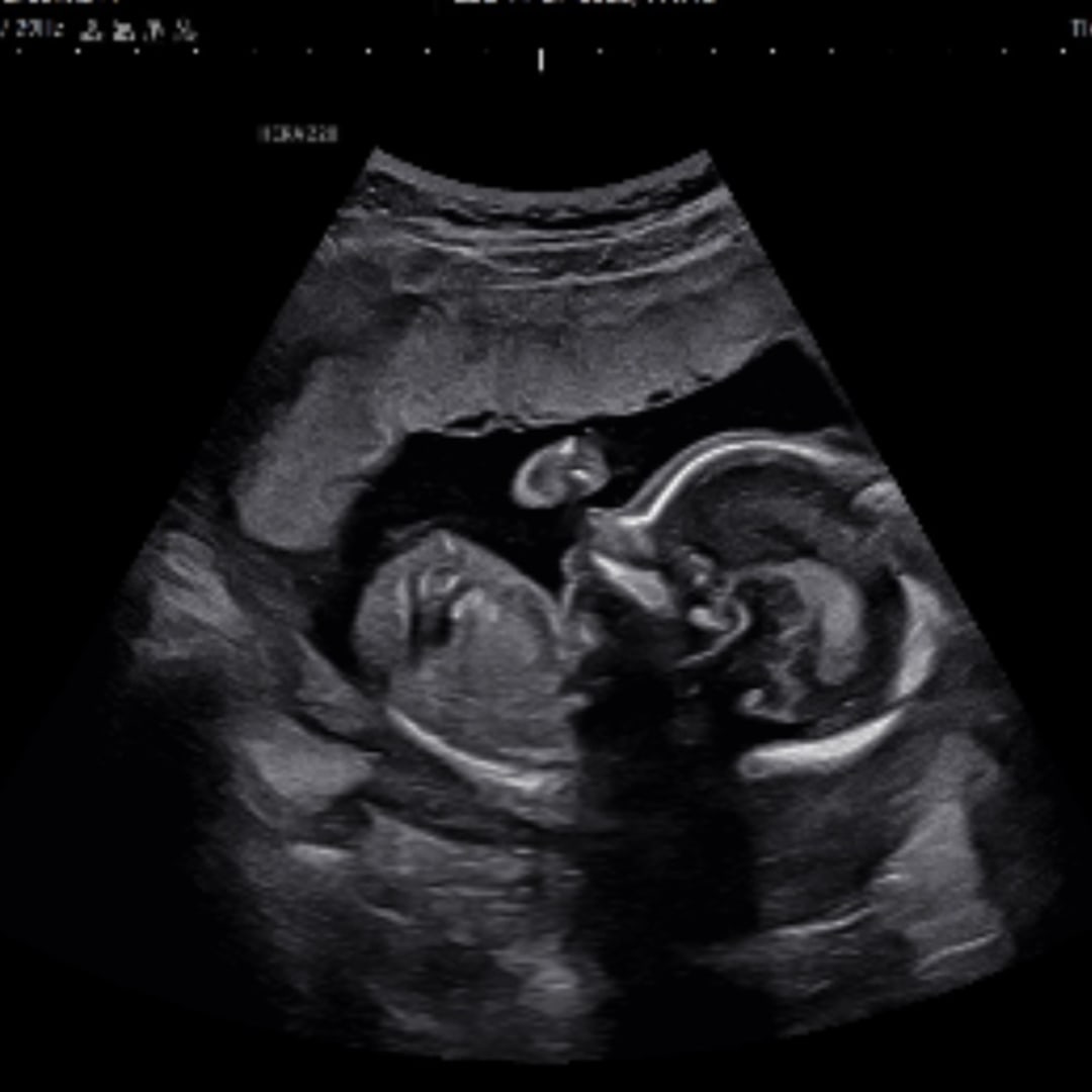 Photo shared by Breanna for their Babylist baby registry.