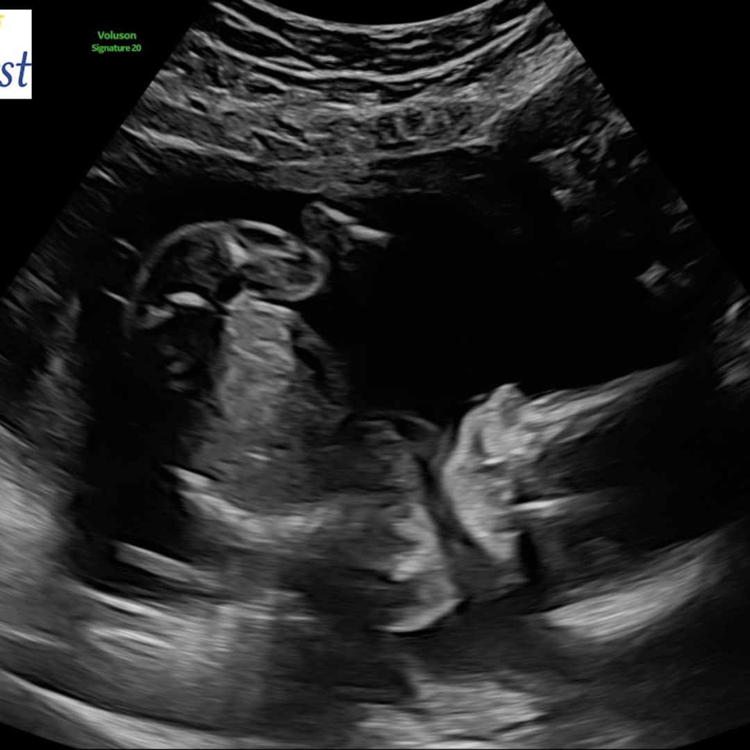 Photo shared by Georgia for their Babylist baby registry.