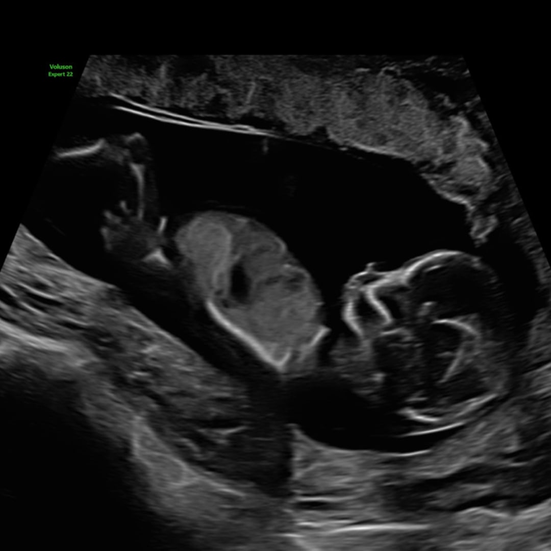 Photo shared by Daniela for their Babylist baby registry.