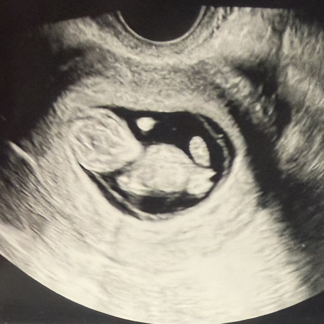 Photo shared by Alyssa for their Babylist baby registry.