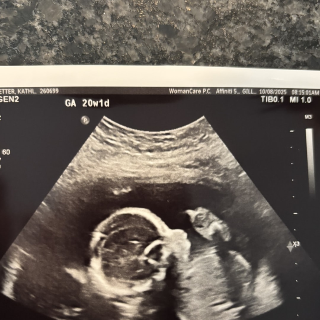 Photo shared by Kathleen for their Babylist baby registry.