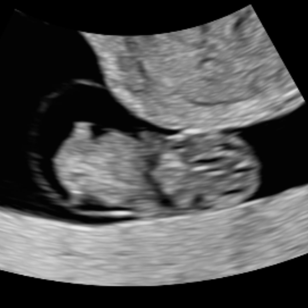 Photo shared by Allison for their Babylist baby registry.