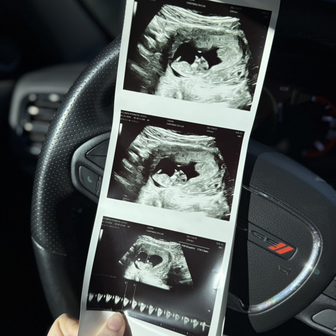 Photo shared by Taylor for their Babylist baby registry.