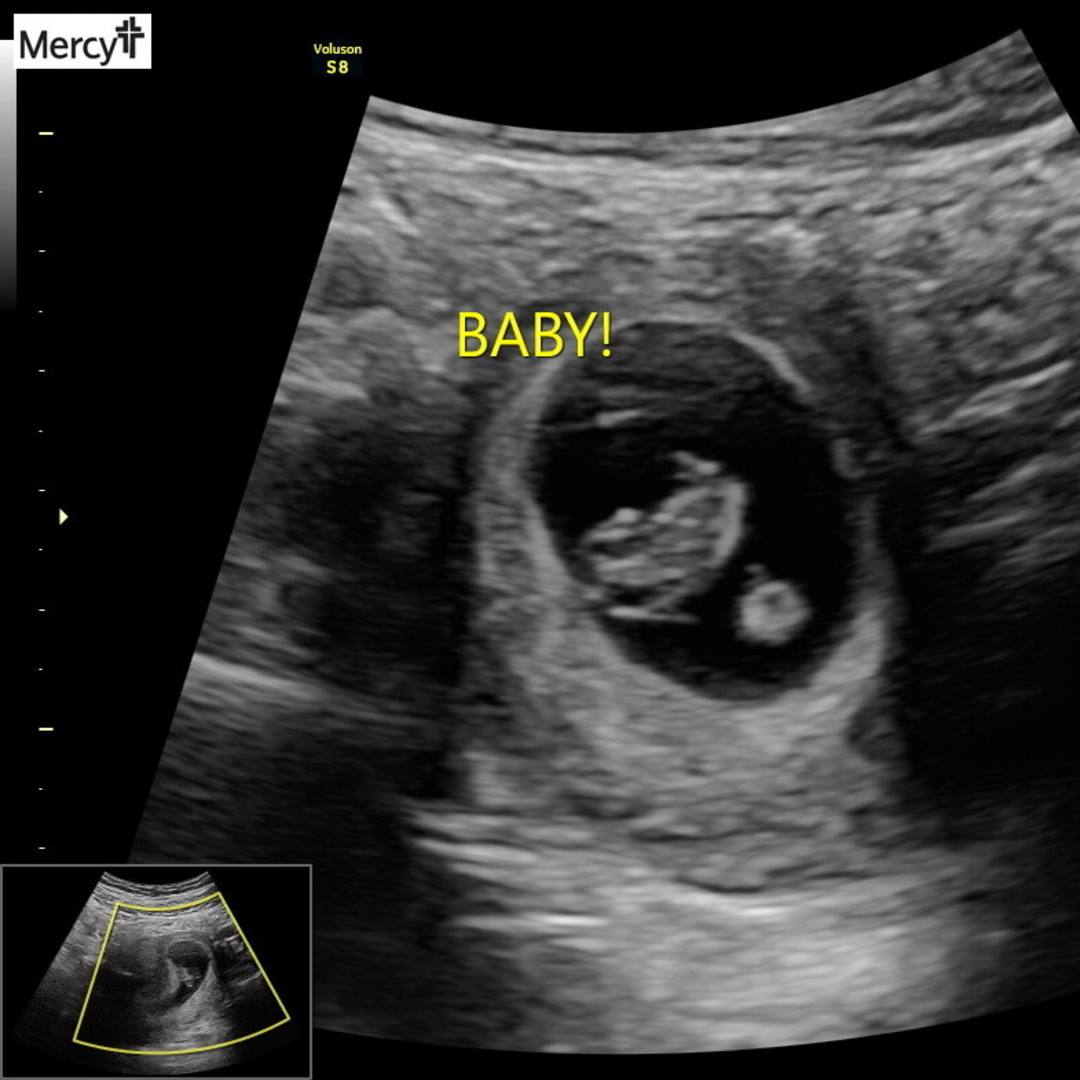 Photo shared by Marrah for their Babylist baby registry.