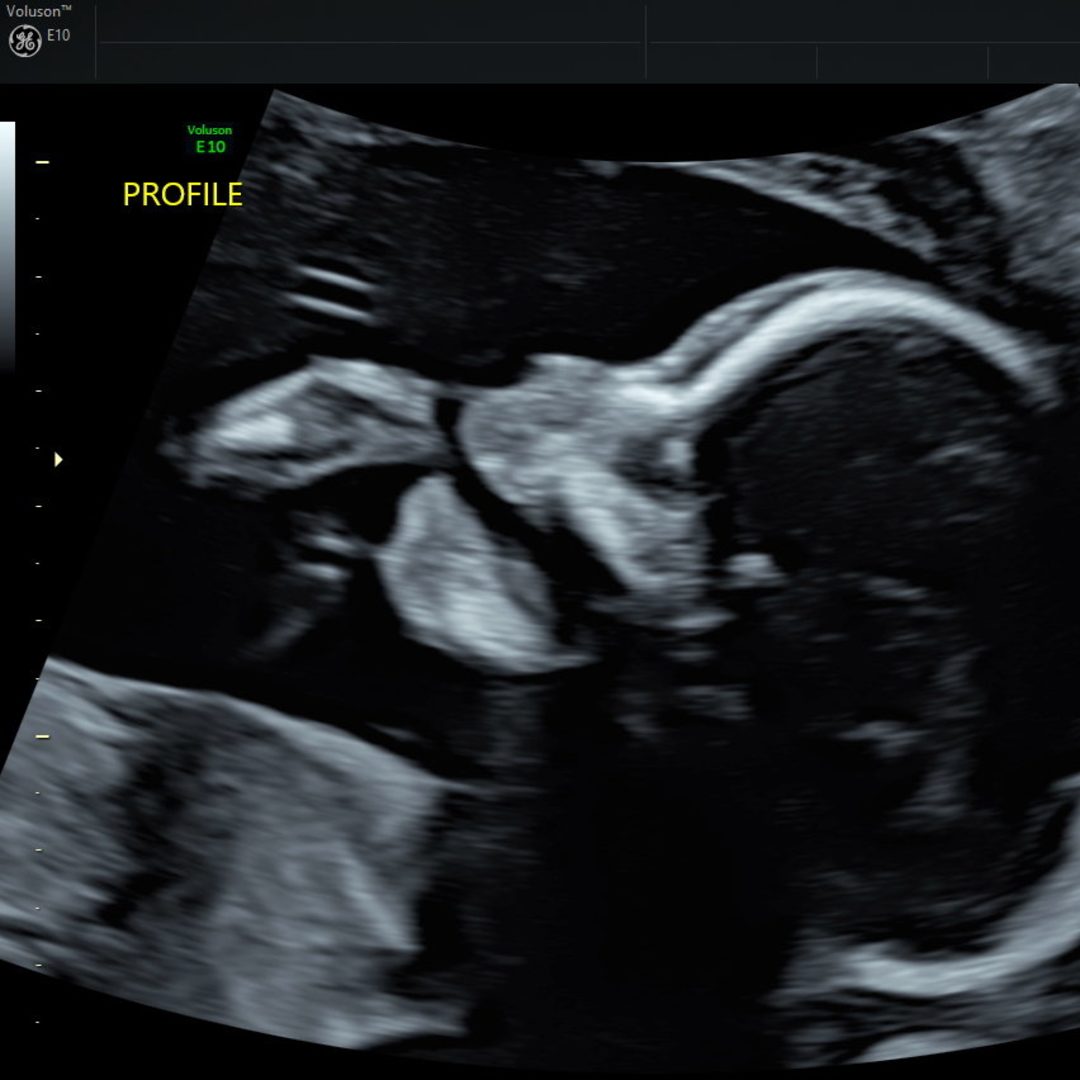 Photo shared by Abigail Mae for their Babylist baby registry.