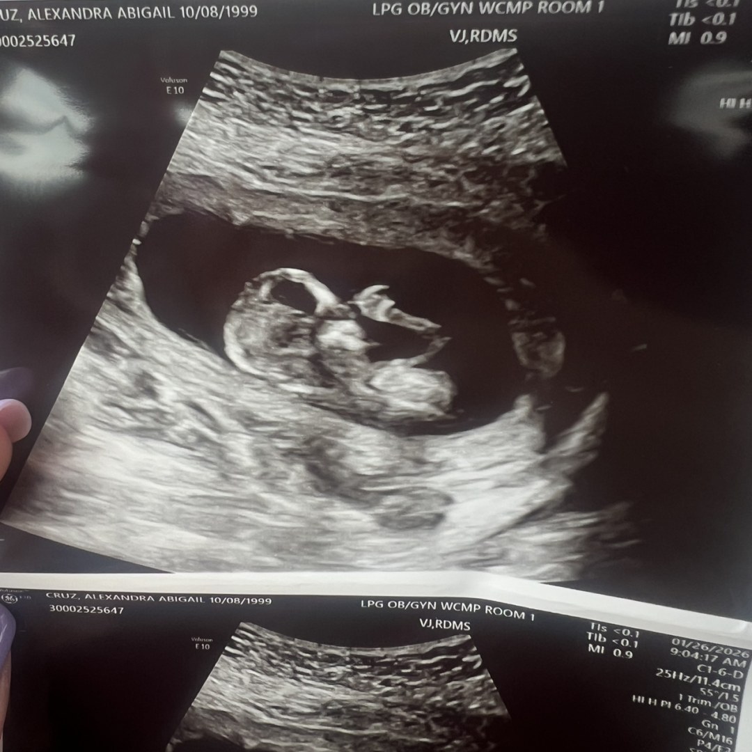 Photo shared by Alexandra for their Babylist baby registry.