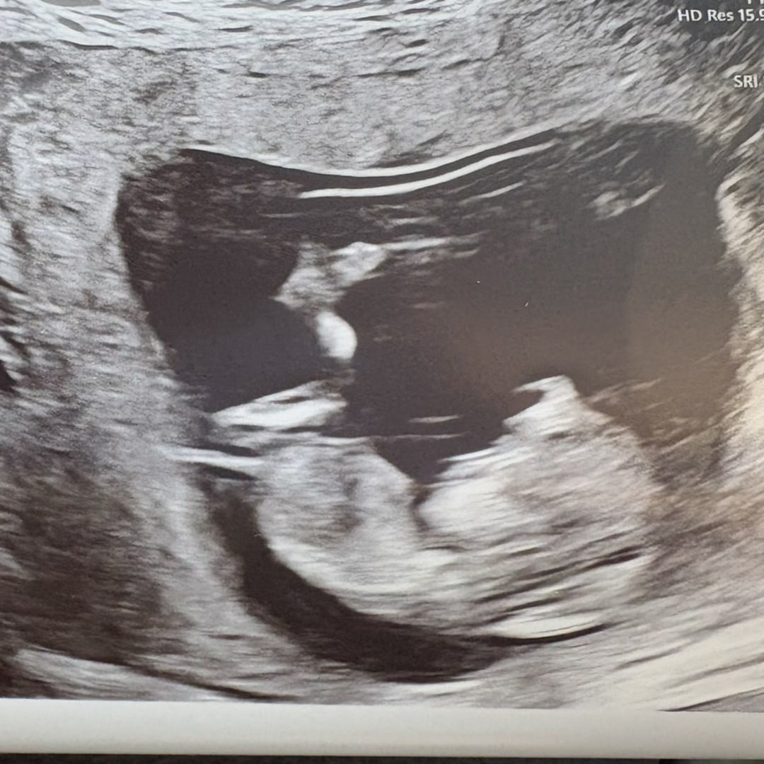 Photo shared by Jamie for their Babylist baby registry.