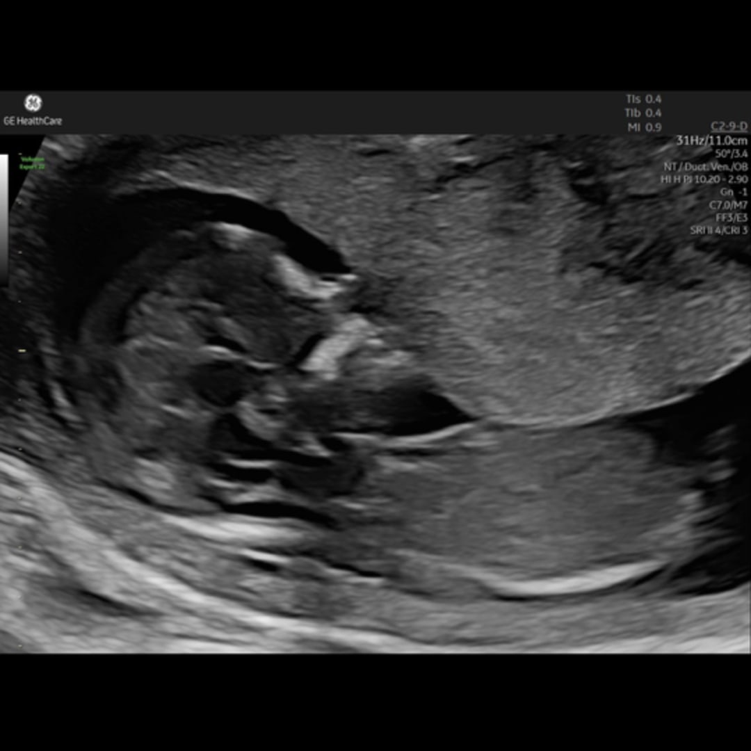 Photo shared by Melanie for their Babylist baby registry.