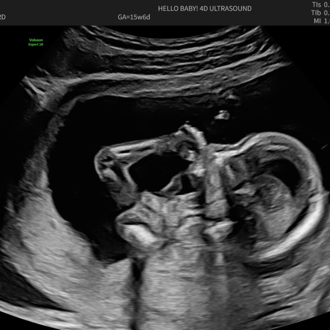 Photo shared by Raven for their Babylist baby registry.