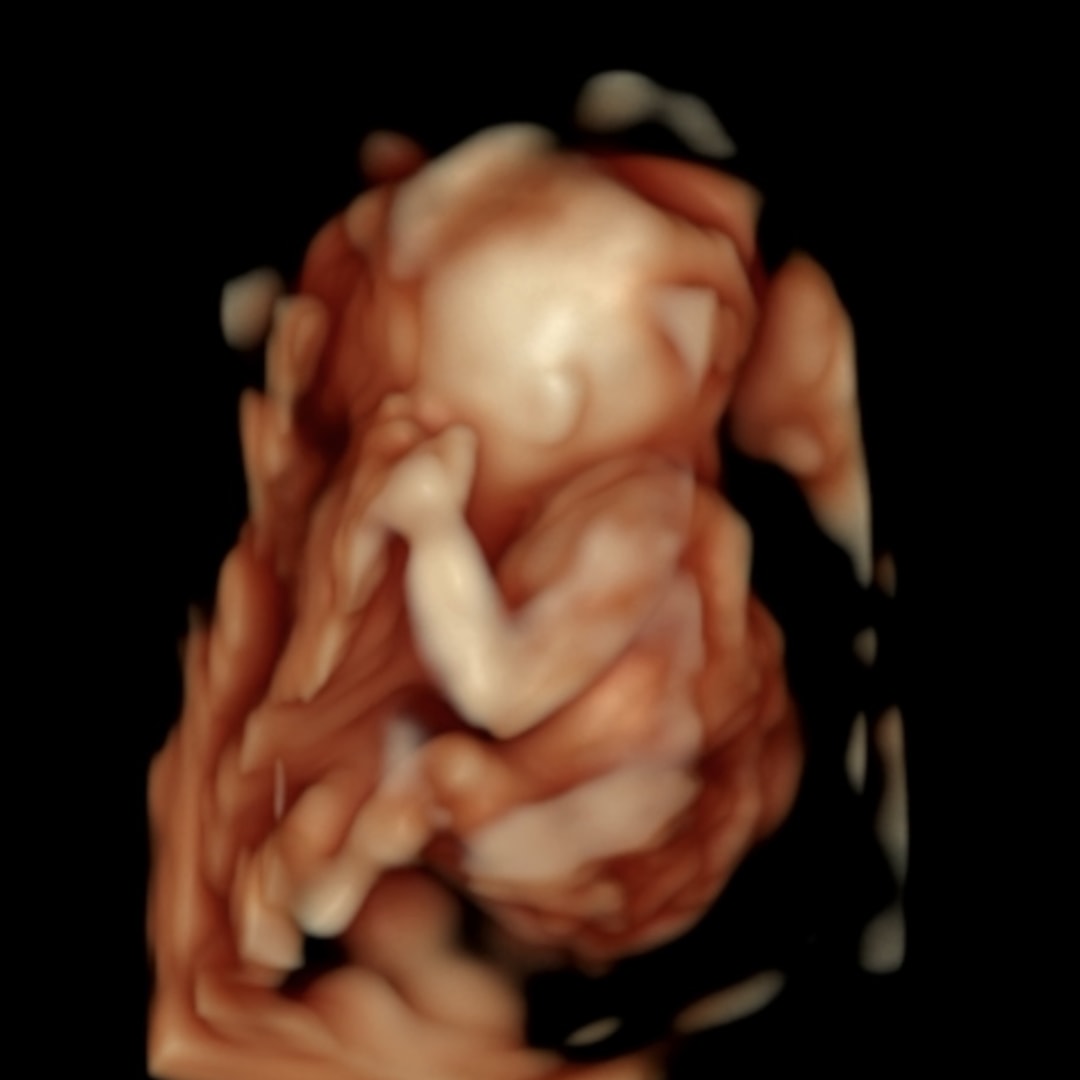 Photo shared by Lucero for their Babylist baby registry.