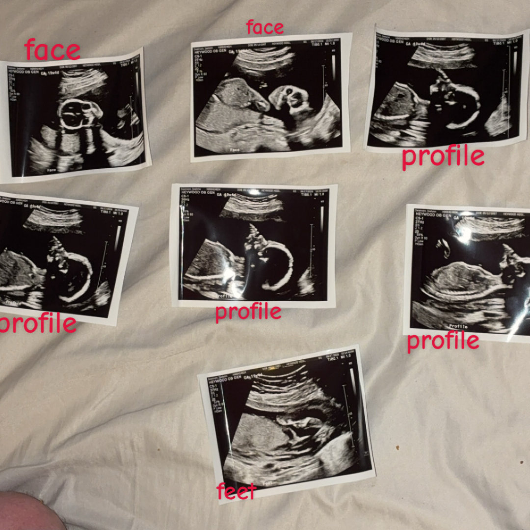 Photo shared by Jaelynn for their Babylist baby registry.