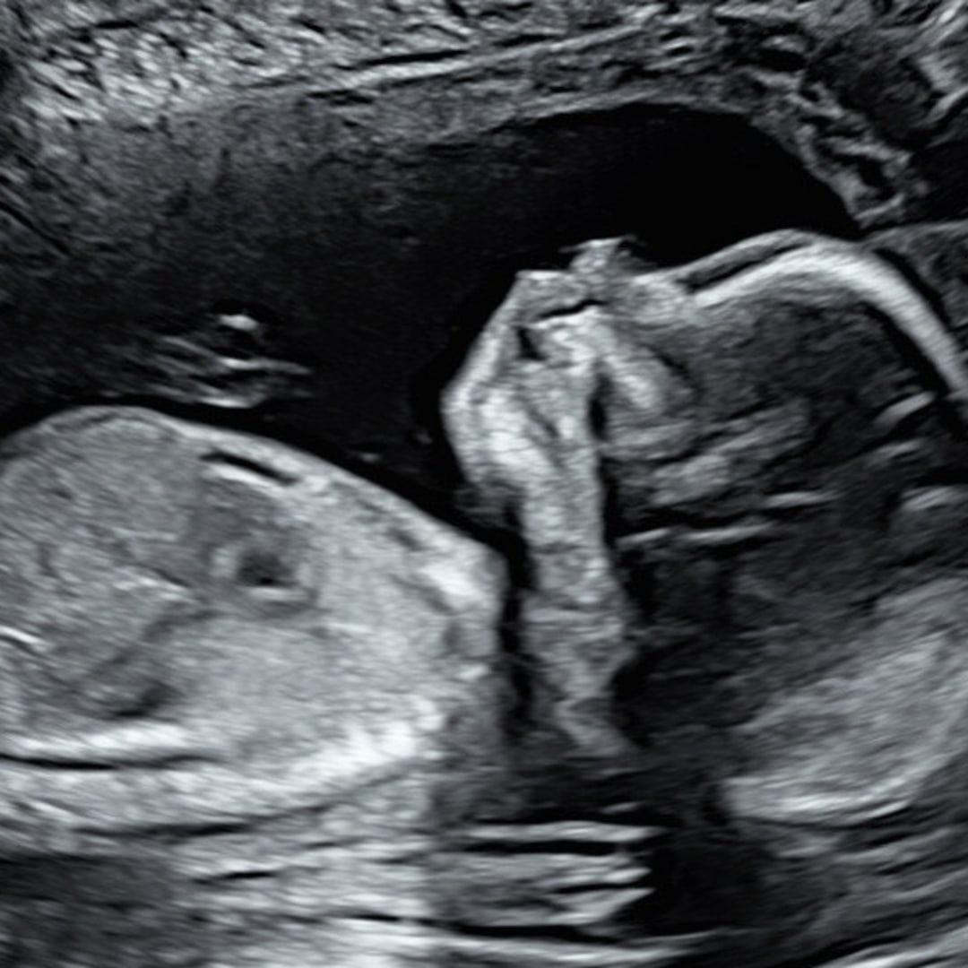 Photo shared by Jacob for their Babylist baby registry.