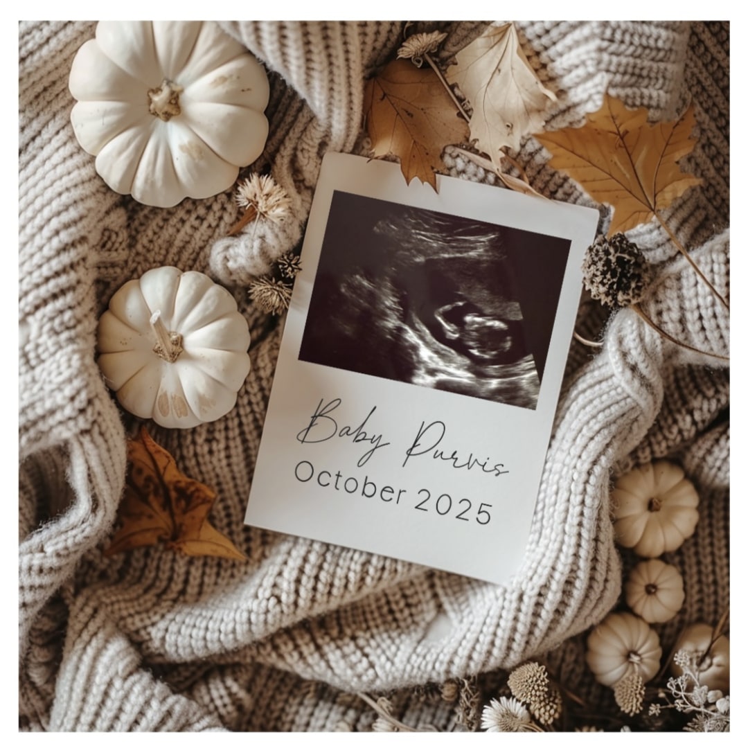 Photo shared by Abbie for their Babylist baby registry.