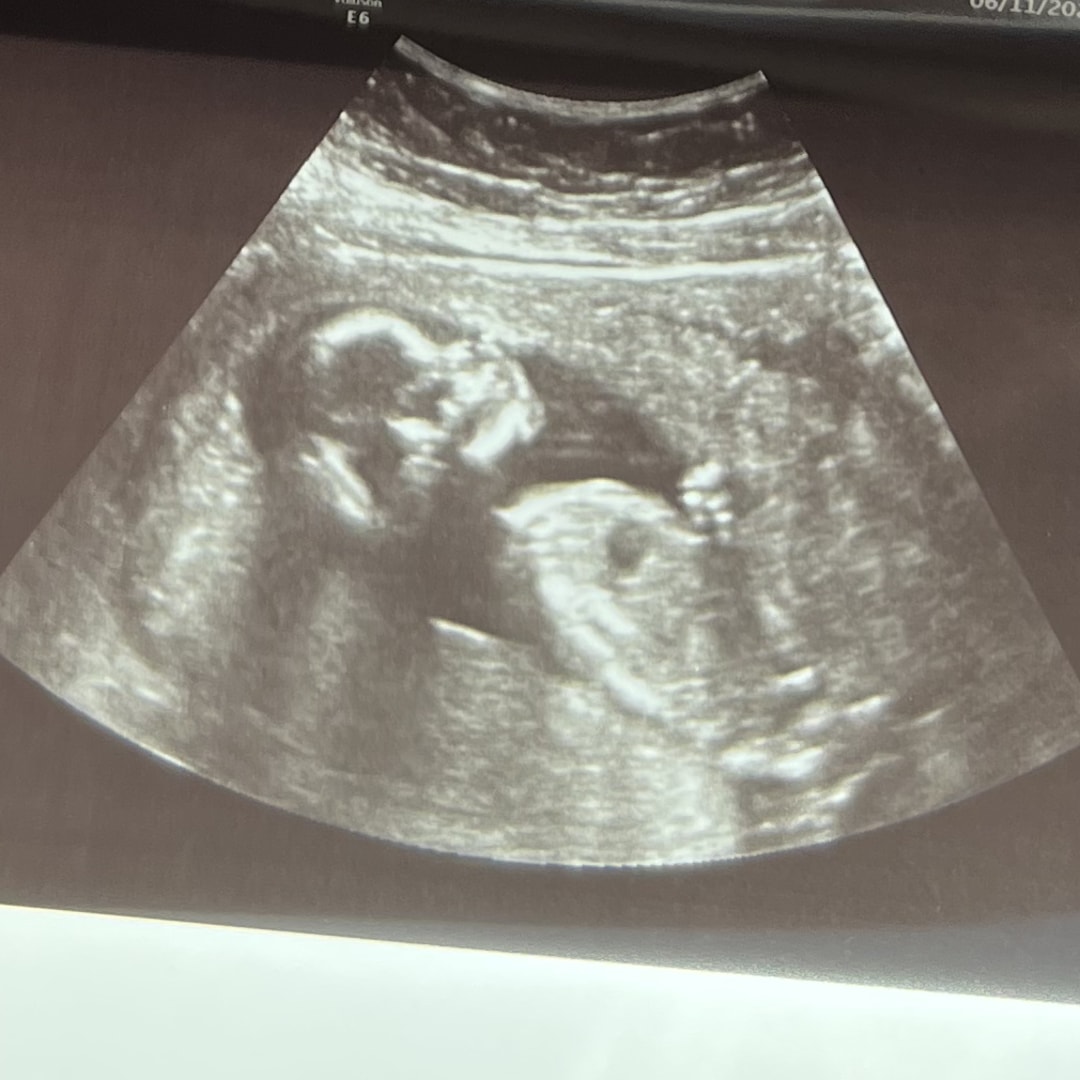 Photo shared by Chelsey for their Babylist baby registry.