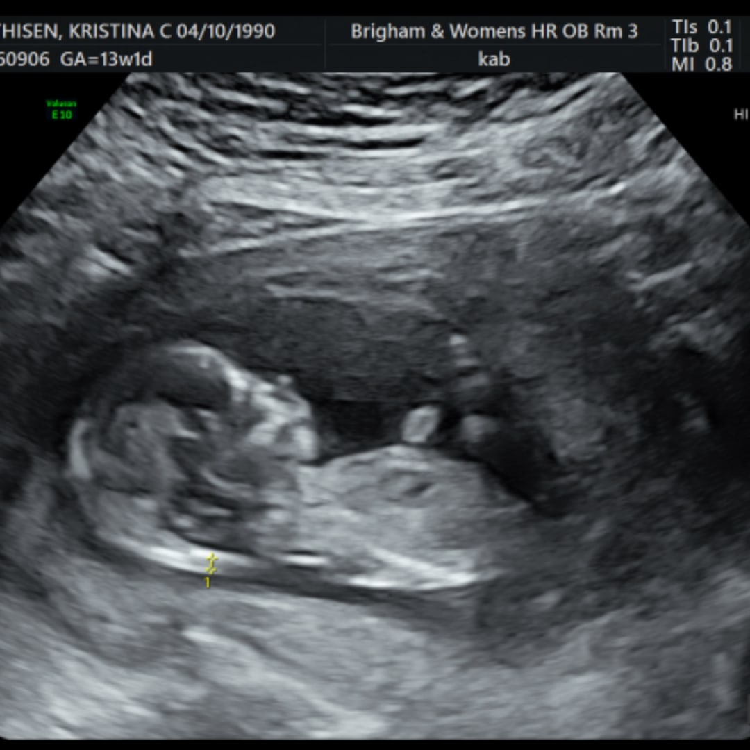 Photo shared by Kristina for their Babylist baby registry.