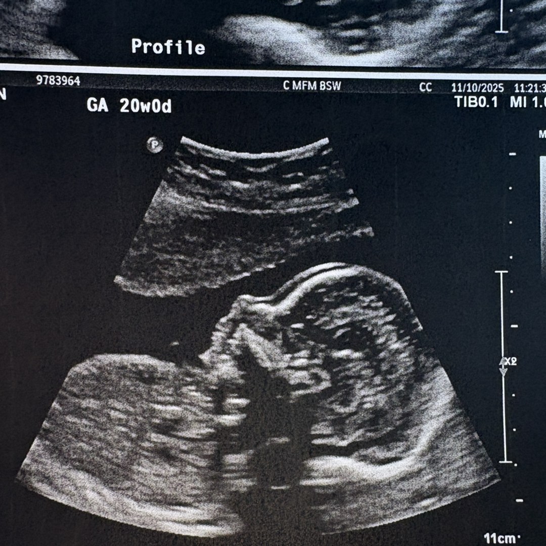 Photo shared by Hope for their Babylist baby registry.