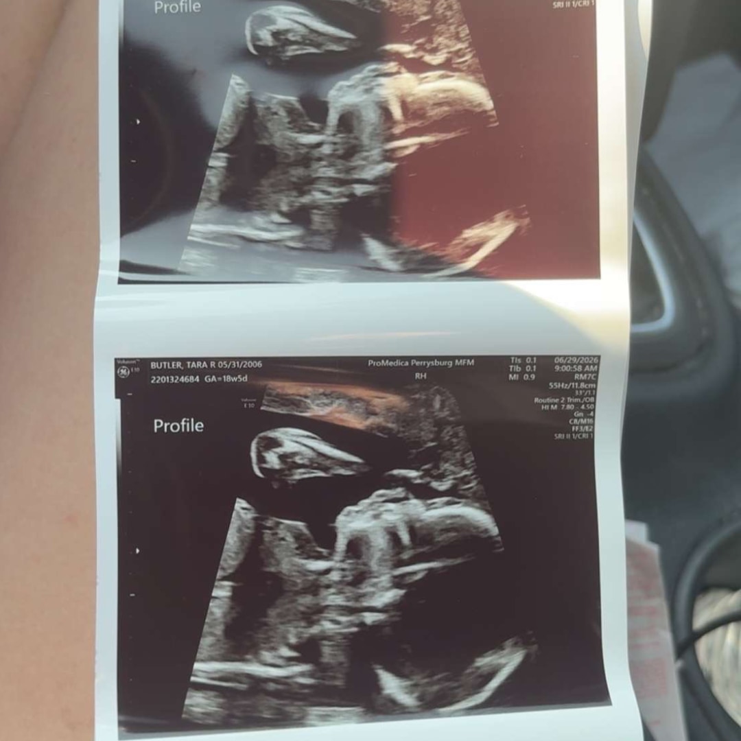 Photo shared by Tara for their Babylist baby registry.