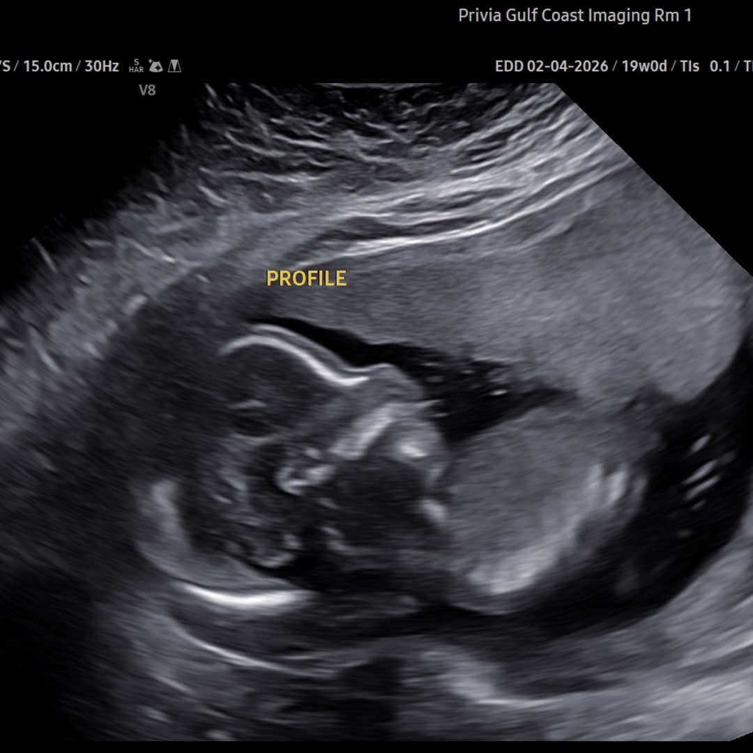 Photo shared by Presleigh for their Babylist baby registry.