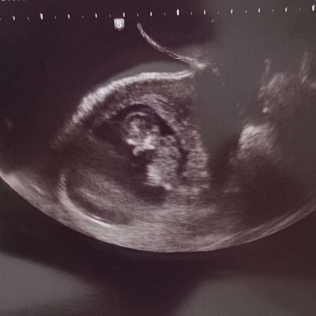 Photo shared by Danielle for their Babylist baby registry.