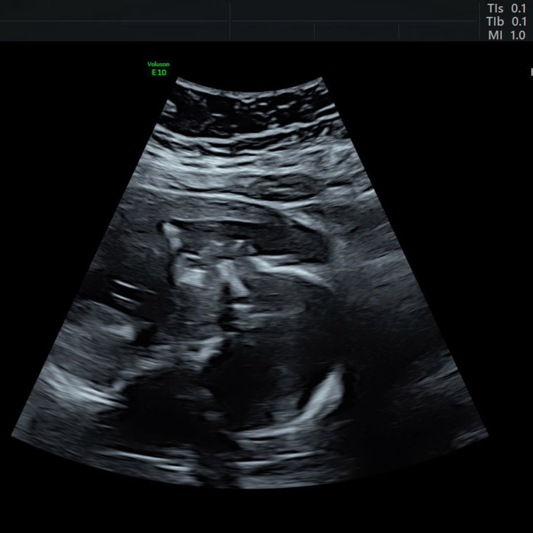Photo shared by Emily for their Babylist baby registry.