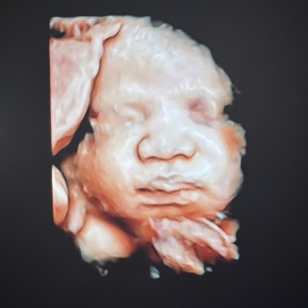 Photo shared by Destiny for their Babylist baby registry.