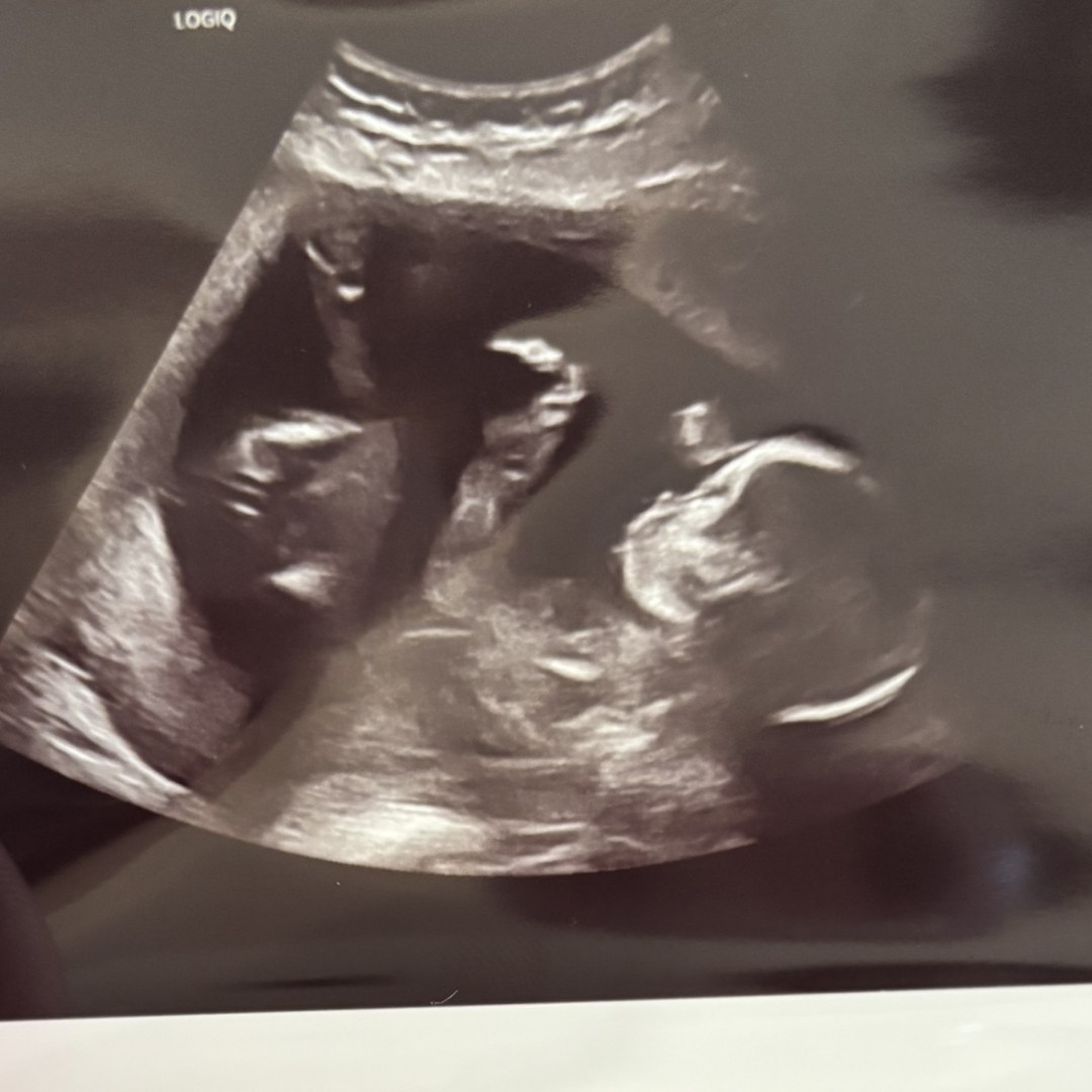 Photo shared by Lizbeth for their Babylist baby registry.