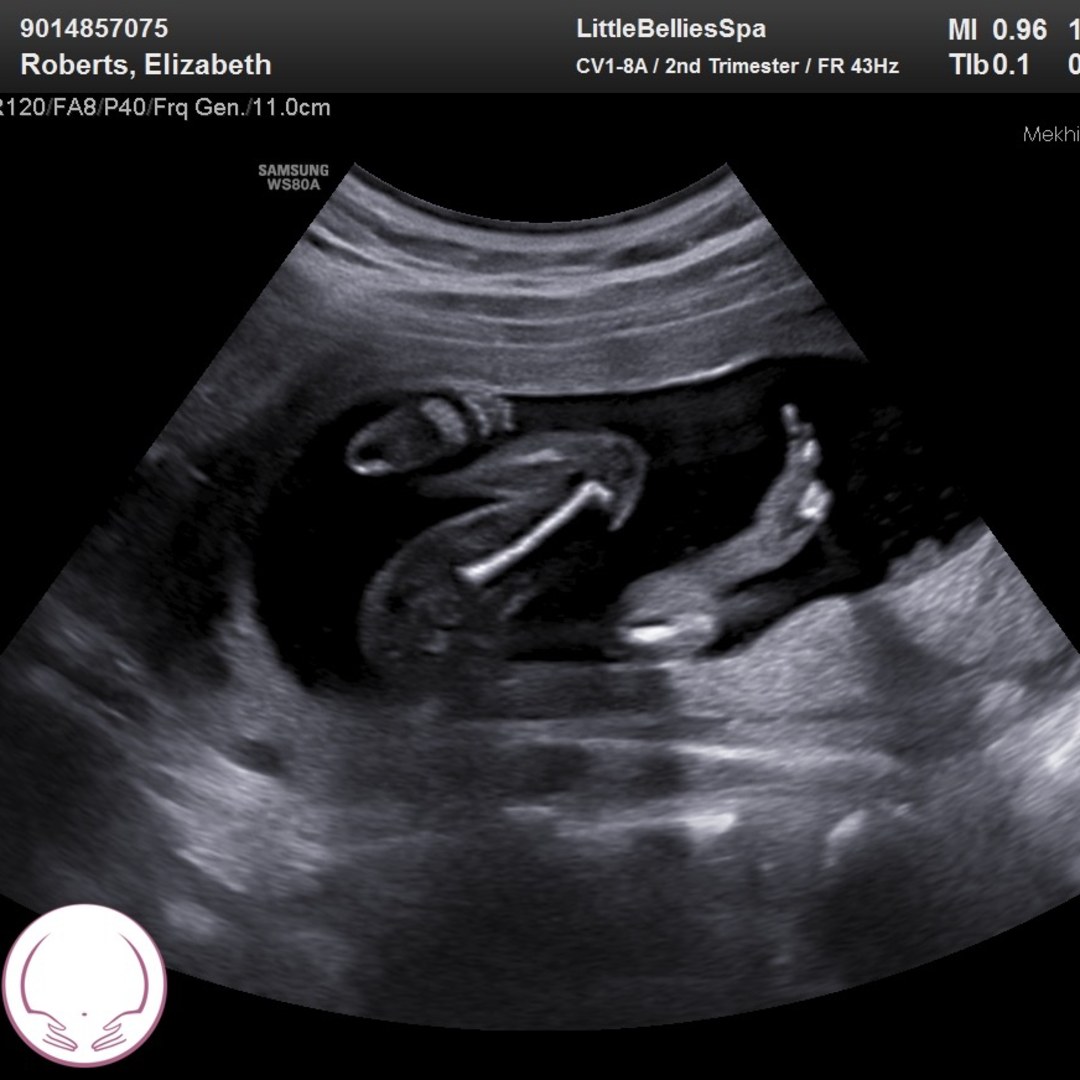 Photo shared by Elizabeth for their Babylist baby registry.