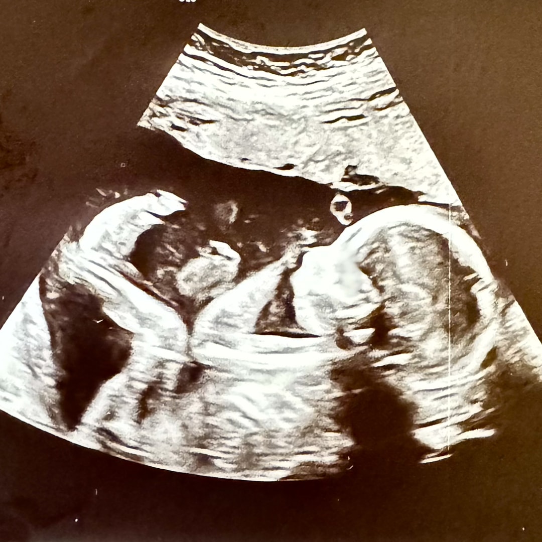 Photo shared by Hannah for their Babylist baby registry.