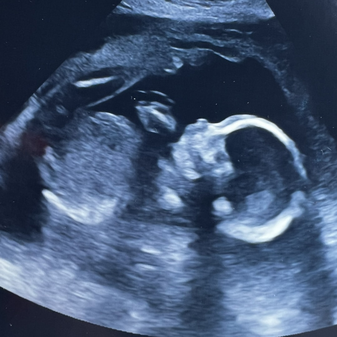 Photo shared by Grace for their Babylist baby registry.