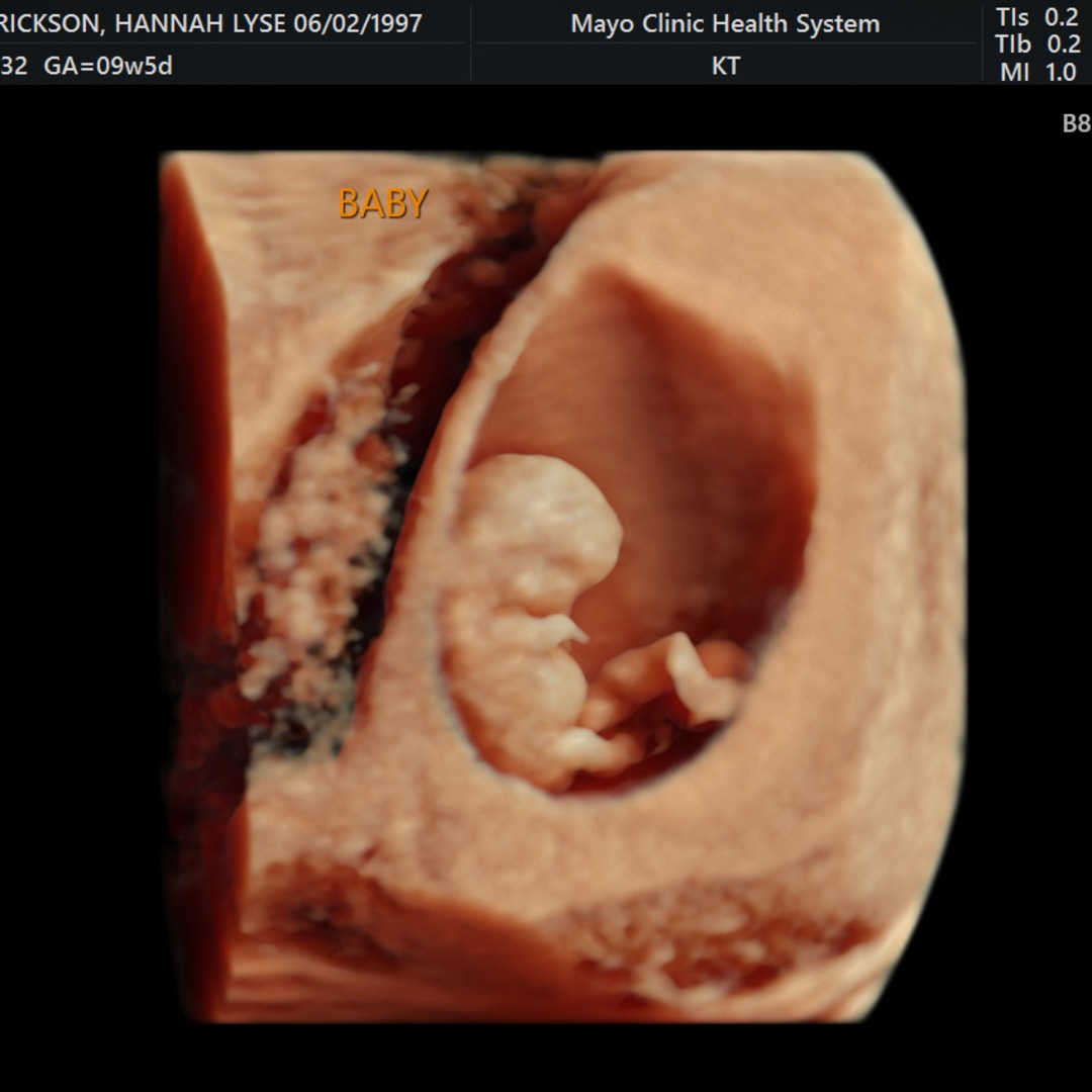 Photo shared by Hannah for their Babylist baby registry.