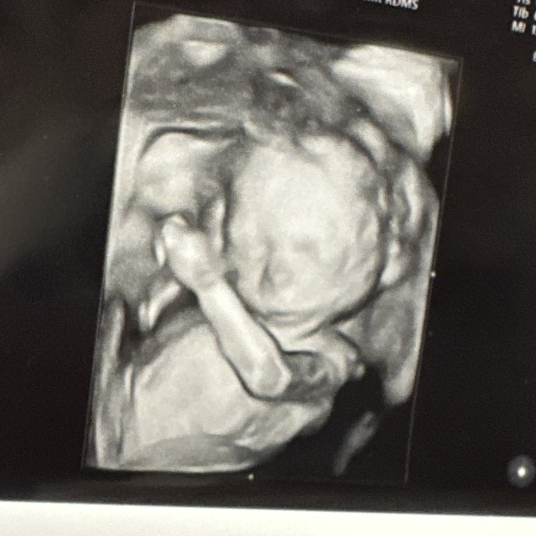 Photo shared by Emma for their Babylist baby registry.