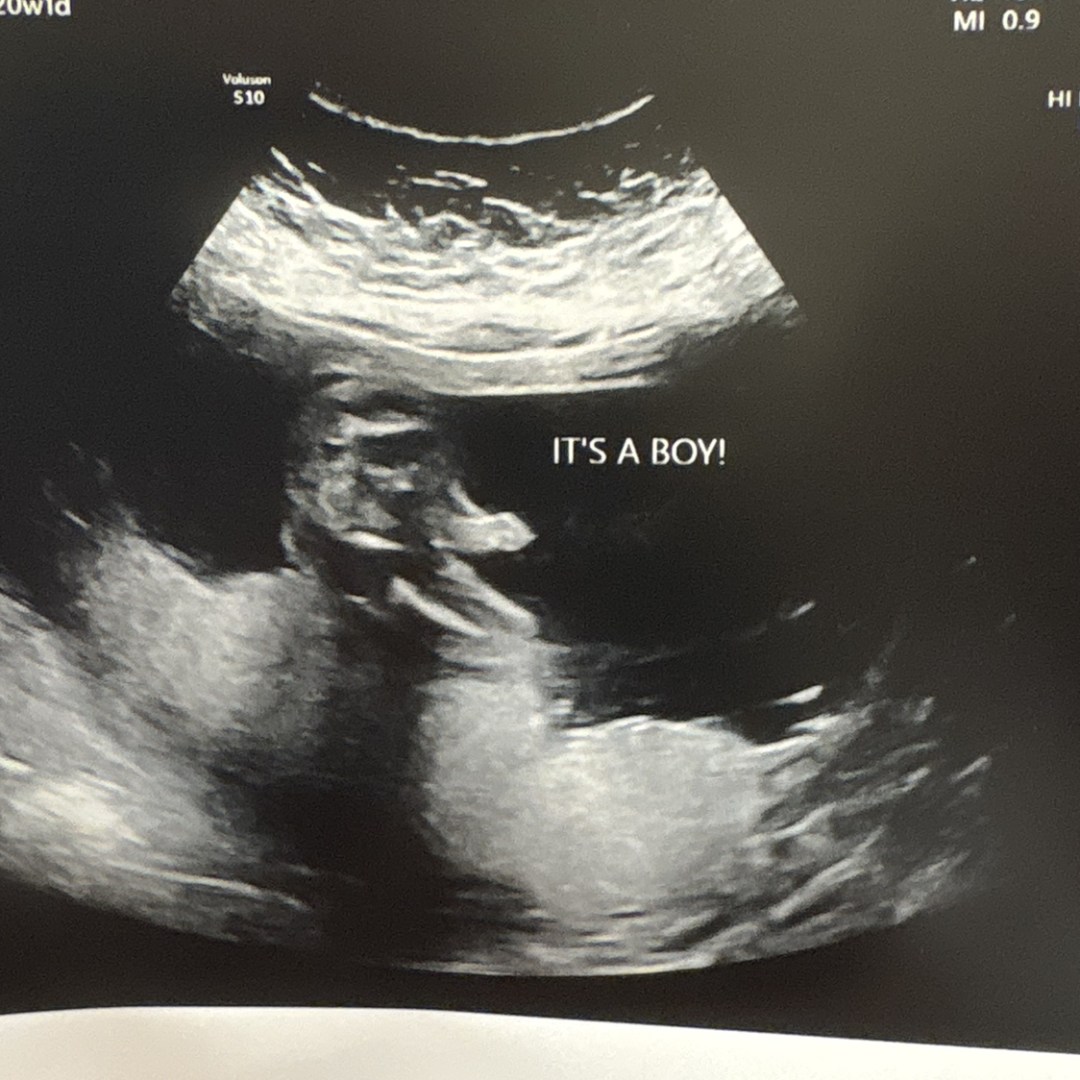 Photo shared by Abigail for their Babylist baby registry.