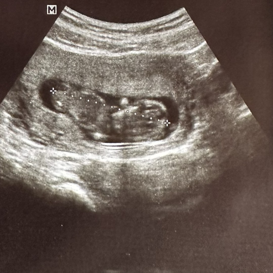 Photo shared by Christina for their Babylist baby registry.