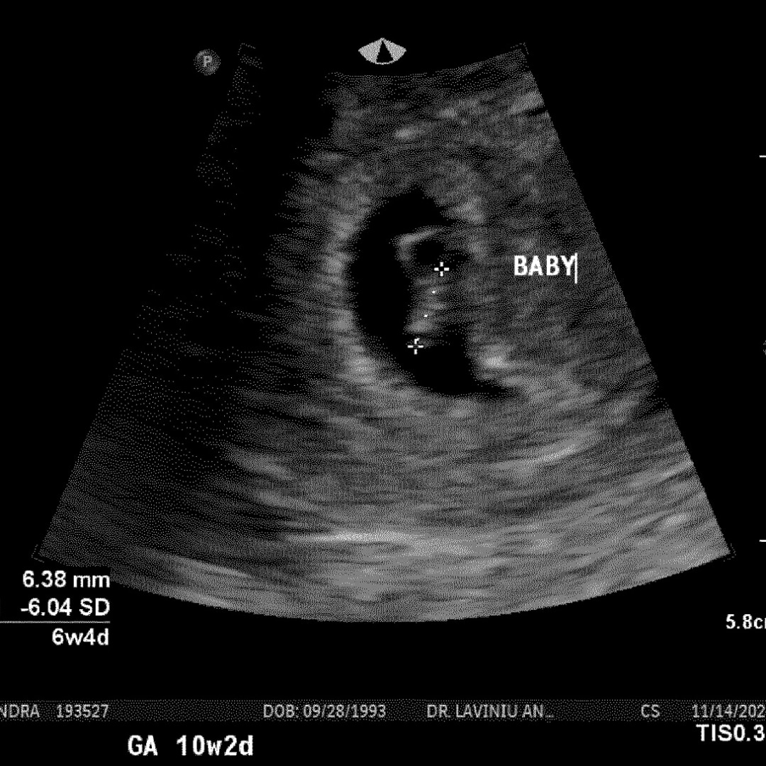 Photo shared by Alejandra for their Babylist baby registry.